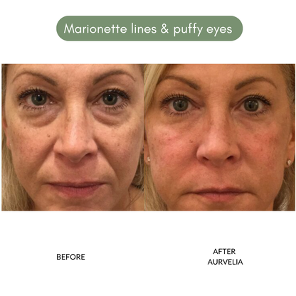 Aurvelia MultiActive Serum™ 2.0