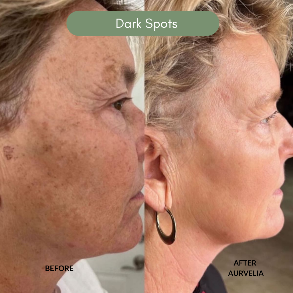 Aurvelia MultiActive Serum™ 2.0